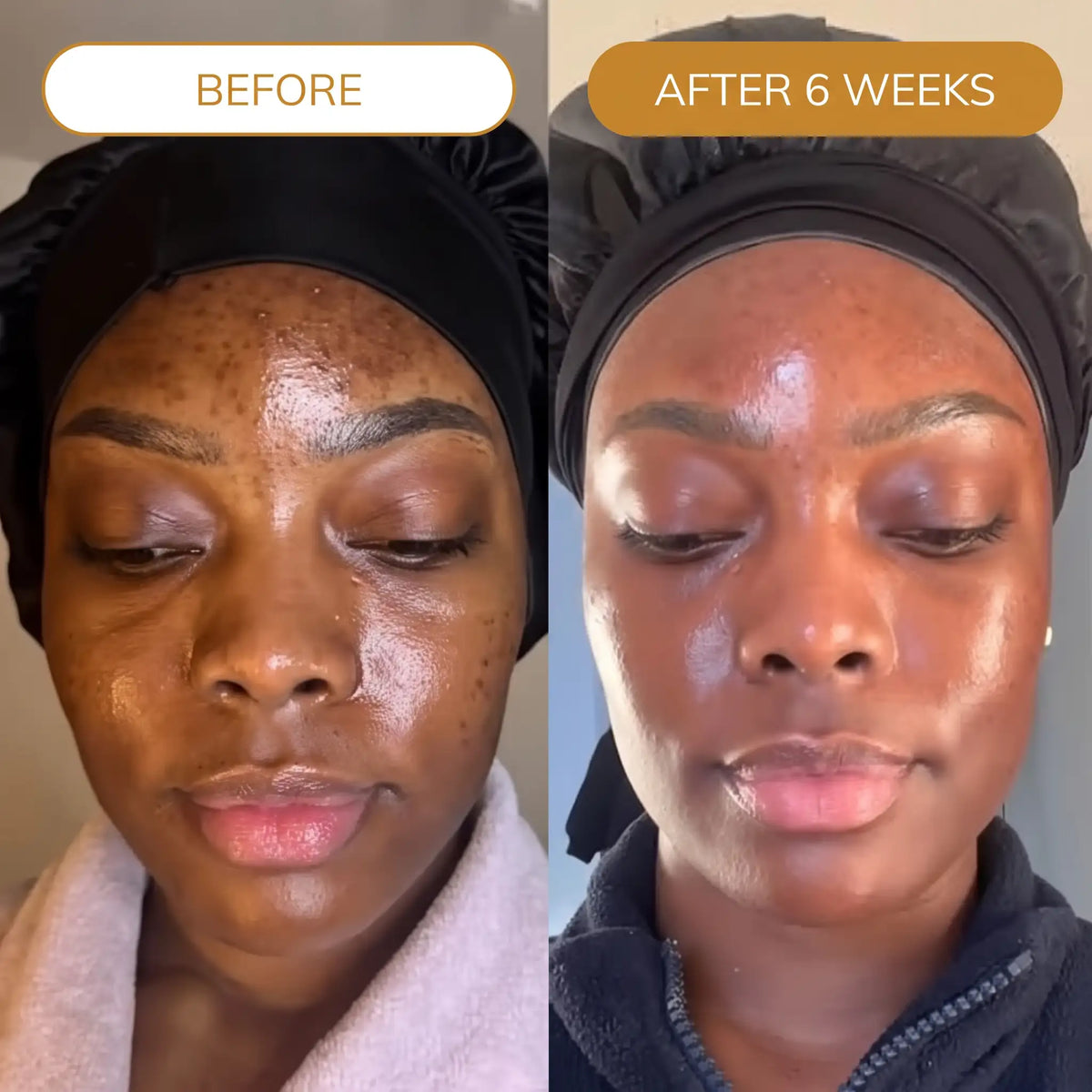 Turmeric Fade & Glow Butter