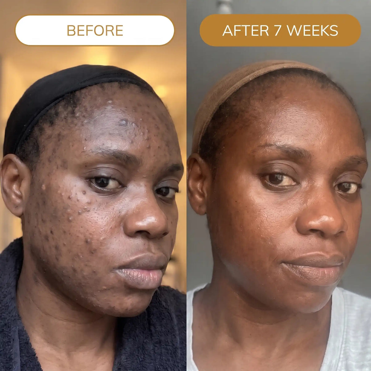 Turmeric Fade & Glow Butter